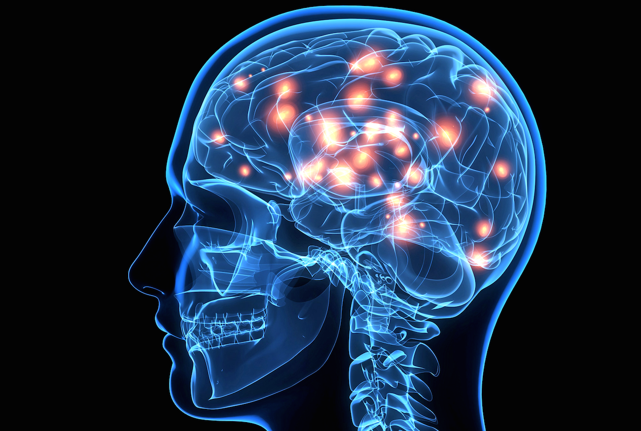 An illustration of a well-functioning brain, symbolizing mental clarity, focus, and sharpness, highlighting the importance of cognitive health.